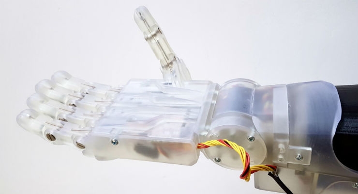 3D printed prosthetic hand 